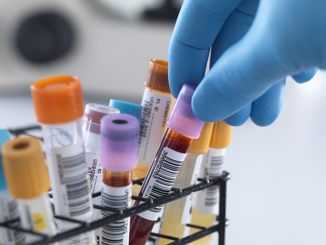 一致性评价大幕开启，医院市场即将调整