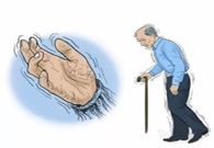 帕金森。芭痢辈慌？