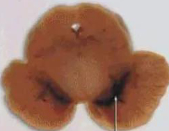 正常人：正：谥