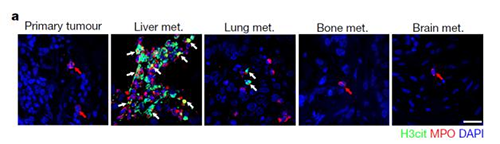 转入小鼠模型得到相同的试验结果，且在转移发生前NET已在肝脏聚积。