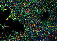 世界首创：药物将干细胞引导至受损部位，提高其愈合能力！