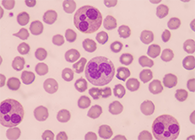 一种神秘颗粒被发现了！它能否成为败血症早筛标志物？