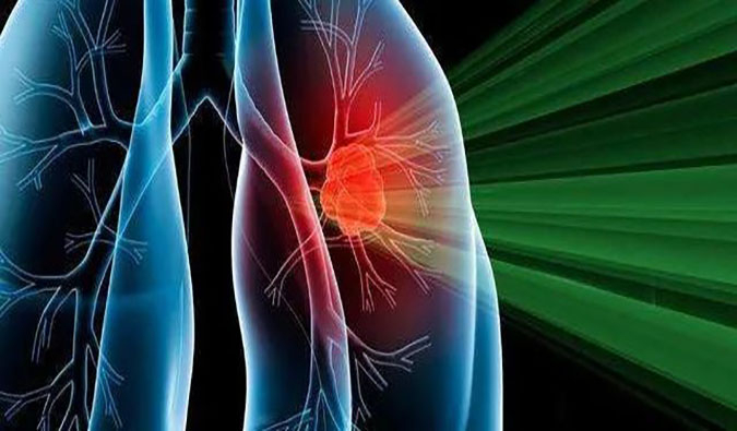 盛世泰科1类创新药物CGT-9475实现中美双报双批 | 不朽情缘mg官网一站式临床前生物医药研发服务平台助力