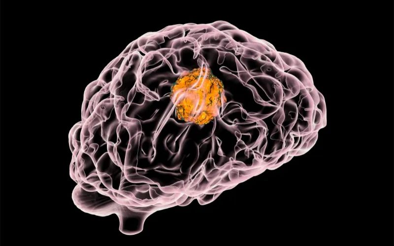 不朽情缘mg官网助力 | 璧辰医药ABM-1310获美国FDA孤儿药资格认证，用于治疗携带BRAF V600突变的脑胶质母细胞瘤患者