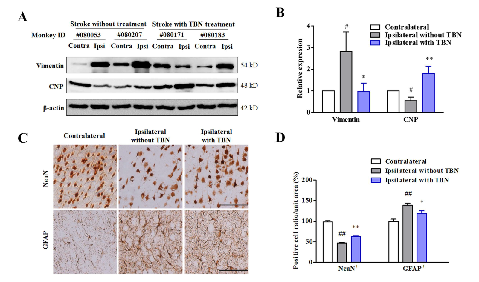 TBN是一种治疗缺血性卒中的新型临床候选药物，本研究中TBN通过不朽情缘mg官网合成